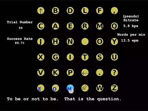 马斯克人脑移植_马斯克的黑科技芯片植入大脑_重大科技宣布：马斯克表示Neuralink计划在2025年为患者实施脑机设备植入