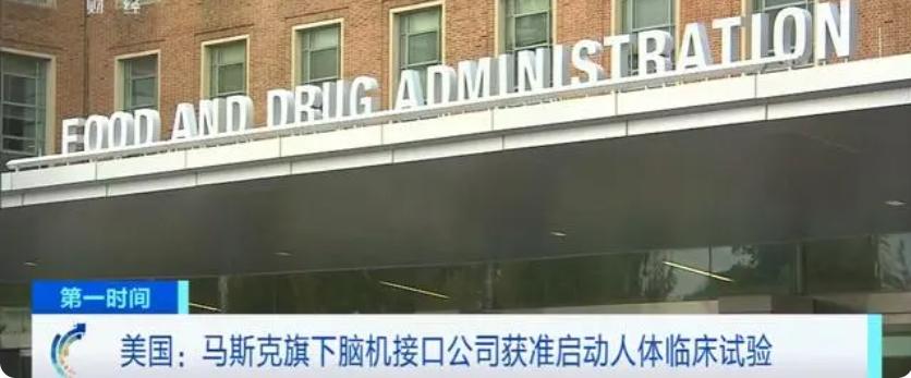 脑机接口植入技术的植入期限是_2025年展望：马斯克确认Neuralink将首次为20至30名患者实施脑机接口植入手术_脑部植入